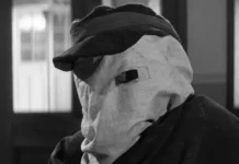 John Hurt nel film The Elephant Man.